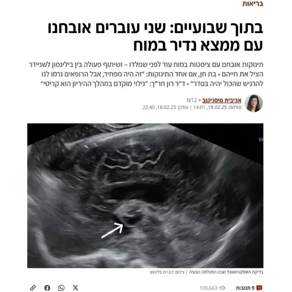 כתבה מאקו – שני עוברים אובחנו עם ממצא נדיר במוח